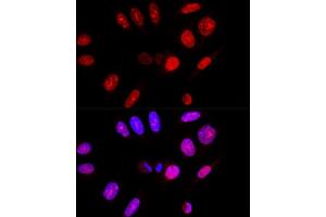 Confocal immunofluorescence analysis of U-2 OS cells using Ataxin-3  Polyclonal Antibody (ABIN3021828, ABIN3021829, ABIN3021830, ABIN1512615 and ABIN6216049) at dilution of 1:100.