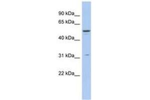 Image no. 1 for anti-Tripartite Motif Containing 14 (TRIM14) (AA 215-264) antibody (ABIN6742515) (TRIM14 anticorps  (AA 215-264))