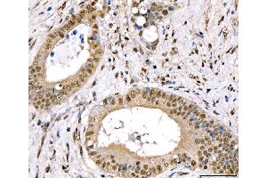 IHC analysis of CRTC3 using anti-CRTC3 antibody (ABIN7599779). (CRTC3 anticorps  (AA 116-619))