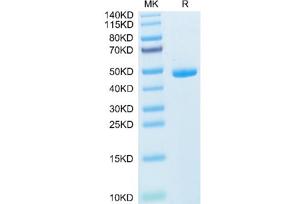 IL-20 Protein (AA 25-176) (Fc Tag)