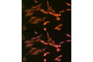 anti-Disrupted in Schizophrenia 1 (DISC1) antibody