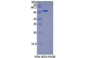 SDS-PAGE analysis of Human Integrin alpha 5 Protein. (ITGA5 Protéine)