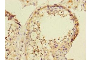 Immunohistochemistry of paraffin-embedded human testis tissue using ABIN7144788 at dilution of 1:100