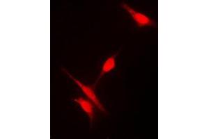 Immunofluorescent analysis of Histone Deacetylase 10 staining in Jurkat cells.