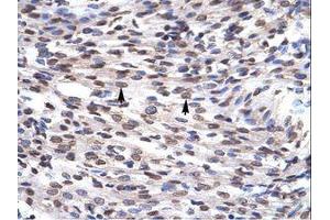 anti-Growth Factor Independent 1B Transcription Repressor (GFI1B) (N-Term) antibody