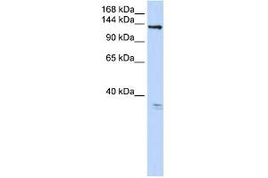 WB Suggested Anti-TMEM16C Antibody Titration:  0. (ANO3 anticorps  (C-Term))