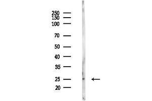 Western blot analysis of lysates from HepG2 cells(LPS, 4h treatment), using RGS17 Antibody at 1/1000 dilution.