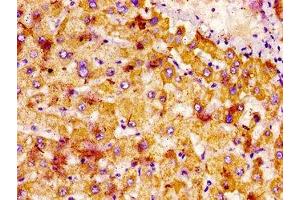 IHC image of ABIN7161191 diluted at 1:400 and staining in paraffin-embedded human liver tissue performed on a Leica BondTM system.