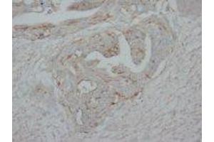 Image no. 1 for anti-Tumor Protein P73 (TP73) (C-Term) antibody (ABIN1492940)