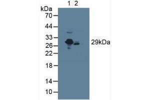 Western blot analysis of (1) Rat Serum and (2) Mouse Serum. (CRP anticorps  (AA 17-224))
