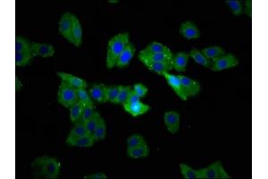 Immunofluorescence staining of HepG2 cells with ABIN7171895 at 1:233, counter-stained with DAPI. (Tetraspanin 9 anticorps  (AA 107-203))