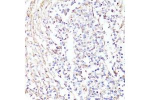 Immunohistochemistry of paraffin-embedded human tonsil using ErbB2 antibody.