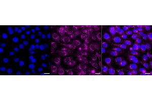 Immunocytochemical staining of HT- cells with Amyloid beta precursor protein antibody (ABIN7797593), 1:1,000). (Recombinant APP anticorps)