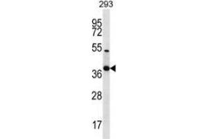 Western blot analysis in 293 cell line lysates (35ug/lane) using NKX2-2  Antibody . (Nkx2-2 anticorps  (Middle Region))