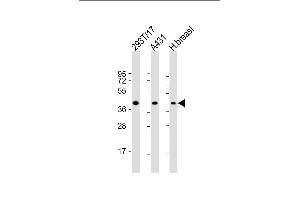 All lanes : Anti-ERLIN2 Antibody (C-term) at 1:2000 dilution Lane 1: 293T/17 whole cell lysate Lane 2: A431 whole cell lysate Lane 3: human breast lysate Lysates/proteins at 20 μg per lane.