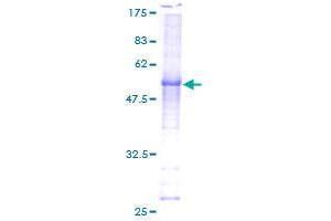 Image no. 1 for Cyclin C (CCNC) (AA 1-283) protein (GST tag) (ABIN1348443)