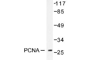 Image no. 1 for anti-Proliferating Cell Nuclear Antigen (PCNA) antibody (ABIN271780) (PCNA anticorps)