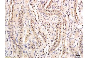Formalin-fixed and paraffin embedded rat kidney labeled with Anti-phospho-AQP2(Ser269) Polyclonal Antibody, Unconjugated  followed by conjugation to the secondary antibody and DAB staining (AQP2 anticorps  (pSer269))