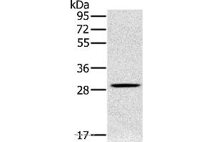 Western blot analysis of Human testis tissue, using CLIC1 Polyclonal Antibody at dilution of 1:400 (CLIC1 anticorps)