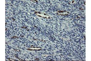 Image no. 4 for anti-GTPase, IMAP Family Member 4 (GIMAP4) antibody (ABIN1498460)