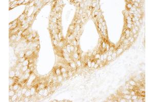 Immunohistochemistry (IHC) image for anti-Protein Kinase, CAMP-Dependent, Regulatory, Type II, alpha (PRKAR2A) (AA 50-100) antibody (ABIN7448741)