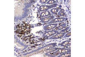 IHC analysis of HE4 using anti-HE4 antibody (ABIN5693137). (WFDC2 anticorps  (AA 31-124))