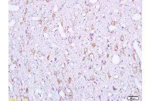 Formalin-fixed and paraffin embedded rat brain labeled with Rabbit Anti Sigma1R/OPRS1/Sigma Receptor Polyclonal Antibody, Unconjugated (ABIN709841) at 1:200 followed by conjugation to the secondary antibody and DAB staining