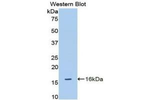 Western blot analysis of the recombinant protein. (ADAMTS1 anticorps  (AA 854-967))
