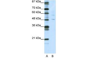 PLAGL1 antibody (20R-1207) used at 0. (PLAGL1 anticorps  (N-Term))