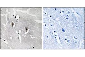Immunohistochemistry analysis of paraffin-embedded human brain tissue, using RBM6 Antibody.