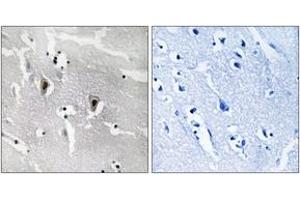 Immunohistochemistry analysis of paraffin-embedded human brain tissue, using RBM6 Antibody. (RBM6 anticorps  (AA 991-1040))