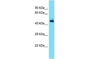 Host: Rabbit Target Name: SERPINA11 Sample Type: Fetal Heart lysates Antibody Dilution: 1.