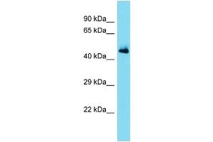 Host: Rabbit Target Name: SERPINA11 Sample Type: Fetal Heart lysates Antibody Dilution: 1. (SERPINA11 anticorps  (Middle Region))