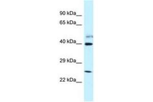 anti-Glutamate Receptor, Ionotropic, N-Methyl D-Aspartate-Like 1A (GRINL1A) (AA 283-332) antibody
