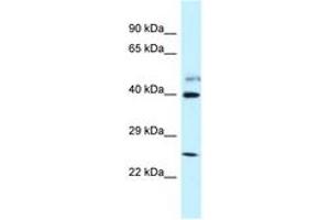 Image no. 1 for anti-Glutamate Receptor, Ionotropic, N-Methyl D-Aspartate-Like 1A (GRINL1A) (AA 283-332) antibody (ABIN6747701) (POLR2M anticorps  (AA 283-332))