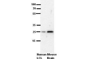 WB Suggested Anti-SH3BGR Antibody Blocking:  5% Milk  Antibody dilution:  1:500  Positive Control:  human LCL and mouse brains (SH3BGR anticorps  (N-Term))