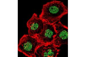 Fluorescent confocal image of A431 cell stained with HOMEZ Antibody (N-term) (ABIN654727 and ABIN2844415). (HOMEZ anticorps  (N-Term))