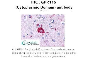 Image no. 1 for anti-G Protein-Coupled Receptor 116 (GPR116) (3rd Cytoplasmic Domain) antibody (ABIN1734907) (G Protein-Coupled Receptor 116 anticorps  (3rd Cytoplasmic Domain))