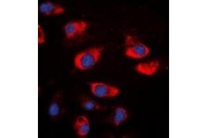 Immunofluorescent analysis of Cystatin A staining in A549 cells. (CSTA anticorps)
