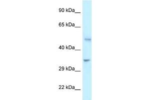 WB Suggested Anti-PFKFB1 Antibody Titration: 1. (PFKFB1 anticorps  (C-Term))