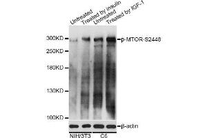 Western blot analysis of extracts of NIH/3T3 and C6 cells, using Phospho-MTOR-S2448 antibody. (MTOR anticorps  (pSer2448))