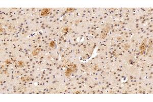 Detection of TKT in Rat Cerebrum Tissue using Polyclonal Antibody to Transketolase (TKT)