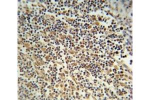 NLRP3 antibody immunohistochemistry analysis in formalin fixed and paraffin embedded human lymph tissue.