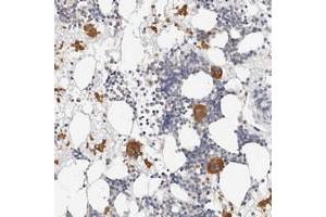 Immunohistochemical staining of human bone marrow with ZRANB1 polyclonal antibody  shows distinct cytoplasmic positivity in bone marrow poietic cells at 1:50-1:200 dilution. (ZRANB1 anticorps)