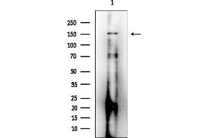 Western blot analysis of lysates from HepG2 cells(LPS 4h treatment), using DDR1 Mouse Monoclonal Antibody at 1/1000 dilution.