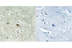 Immunohistochemistry analysis of paraffin-embedded human brain tissue using NDUFV3 antibody. (NDUFV3 anticorps)
