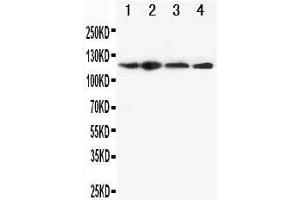 Anti-CIAS1/NALP3 antibody, Western blotting Lane 1: HEP-2 Cell Lysate Lane 2: A549 Cell Lysate Lane 3: U87 Cell Lysate Lane 4: CEM Cell Lysate (NLRP3 anticorps  (N-Term))