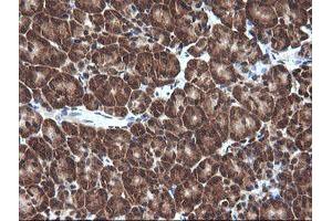 Image no. 7 for anti-Von Hippel-Lindau Tumor Suppressor, E3 Ubiquitin Protein Ligase (VHL) antibody (ABIN1501712)