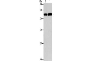 Western Blotting (WB) image for anti-Toll-Like Receptor 3 (TLR3) antibody (ABIN2421027) (TLR3 anticorps)