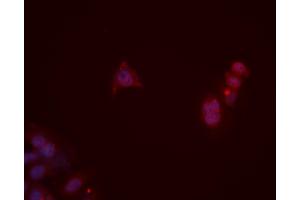 ABIN6276107 staining HeLa cells by ICC/IF.